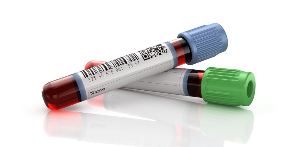 government-is-getting-behind-blood-test-for-cancer